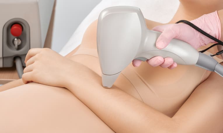 Korean DPL Hair-Removal - Arm